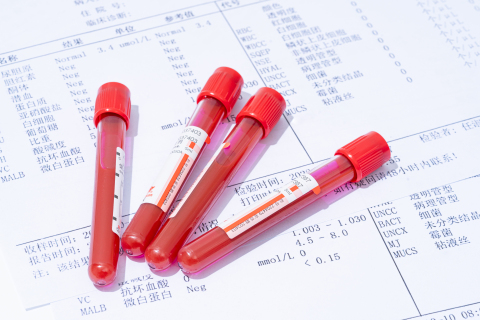 疫情核酸检测医用试剂管高清图 疫情核酸检测医用试剂管高清图