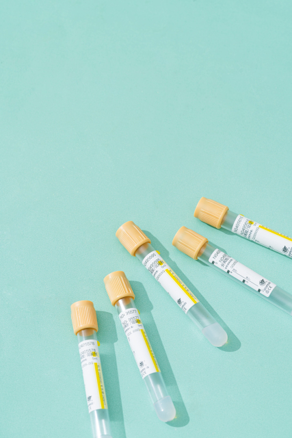 医用检测试管试剂管高清图